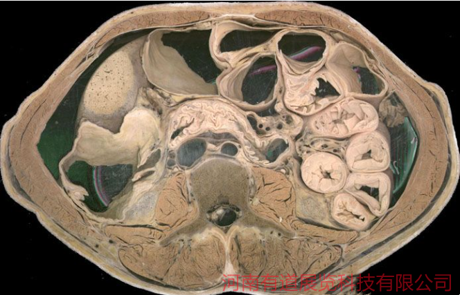 腹部水平断面